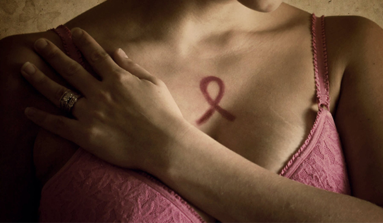 Breast Cancer